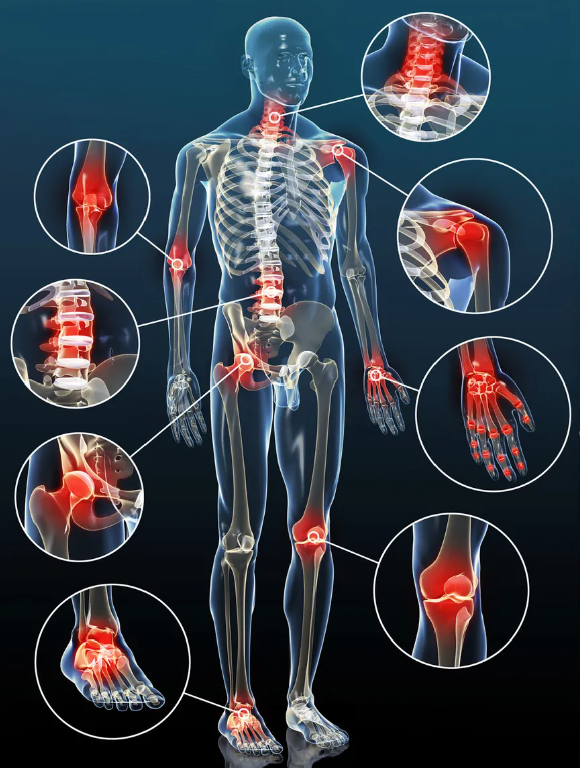 SPRAY ANALGÉSICO DE ACCIÓN RÁPIDA